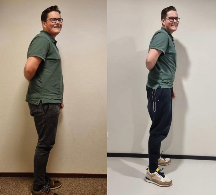 Mann vor und nach Fitness-Ernährungsprogramm, zeigt Gewichtsverlust und verbesserte Haltung.